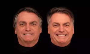 Bolsonaro antes e depois dos procedimentos estéticos (Foto: Divulgação/Reprodução/Imagem disponível na internet).